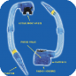 Bone Induction